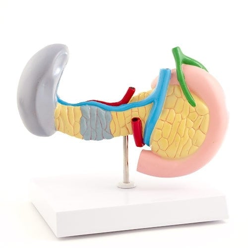 Pancreas, Spleen & Gallbladder Model with Diseases