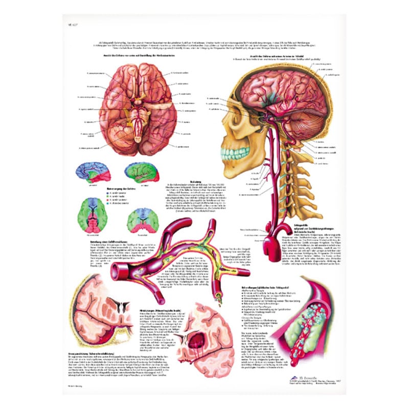 Stroke Wall Chart German