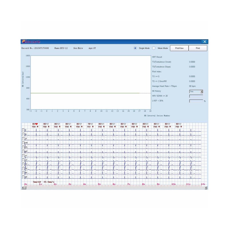 PC ECG Biocare ECG-2000