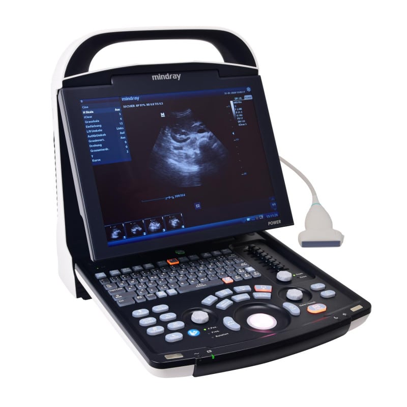 Mindray DP 30 without battery | convex transducer (35C50EA)