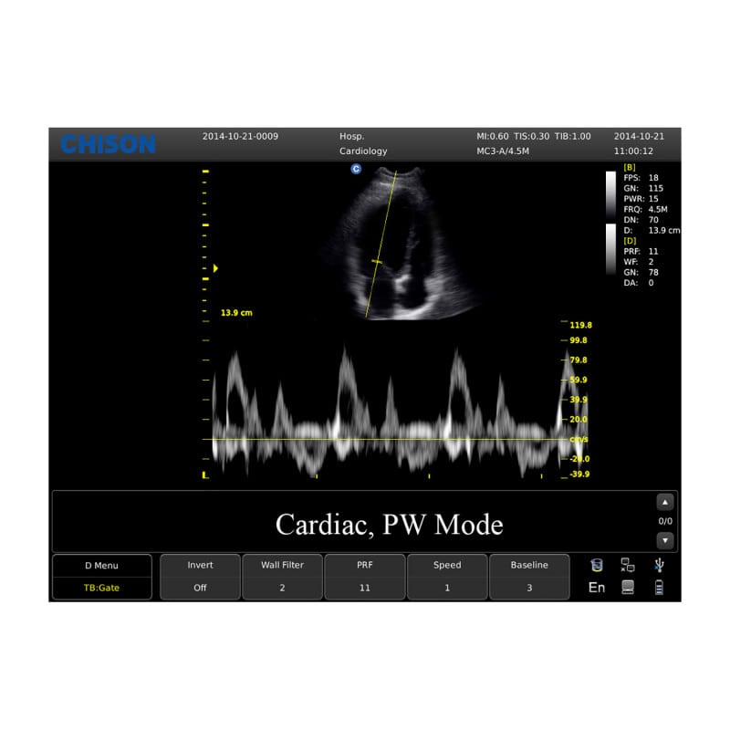 CHISON ECO3 Expert Ultrasound Machine with convex transducer (C3-A)