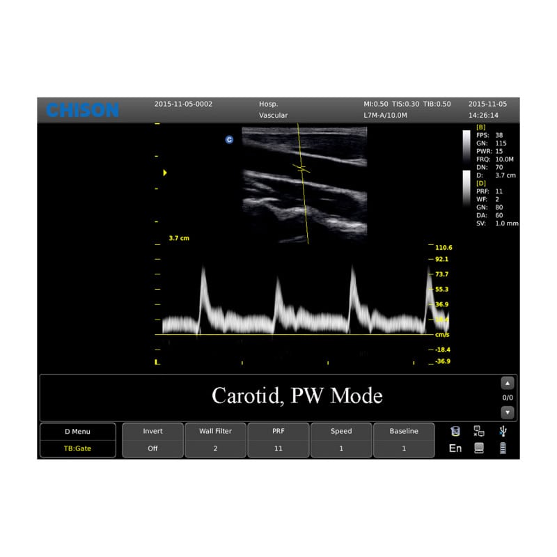 CHISON ECO3 Expert Ultrasound Machine with convex transducer (C3-A)