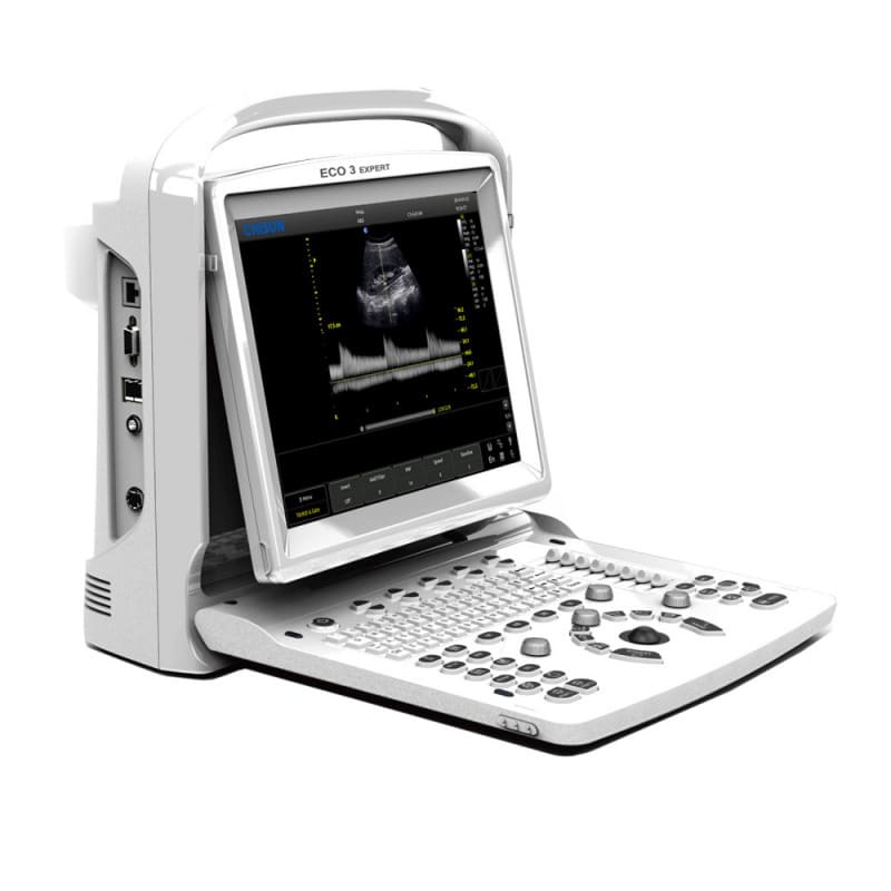 CHISON ECO3 incl. Ultrasound Trolley with convex probe