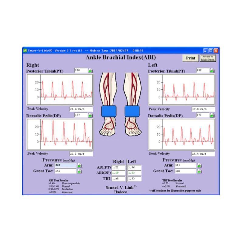 Smart-V-Link Software