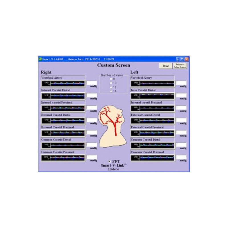 Smart-V-Link Software