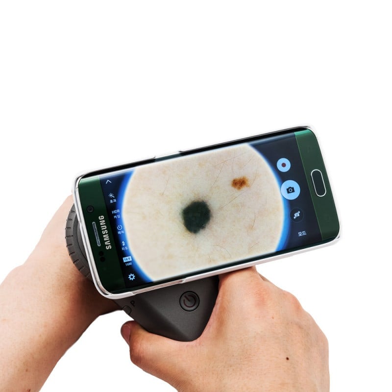 DermoScan Smartphone Adapter for Samsung Galaxy S6