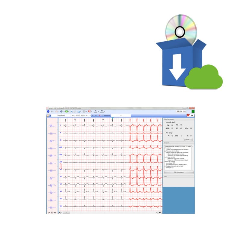ECG-1000 ECG Management Software for Biocare