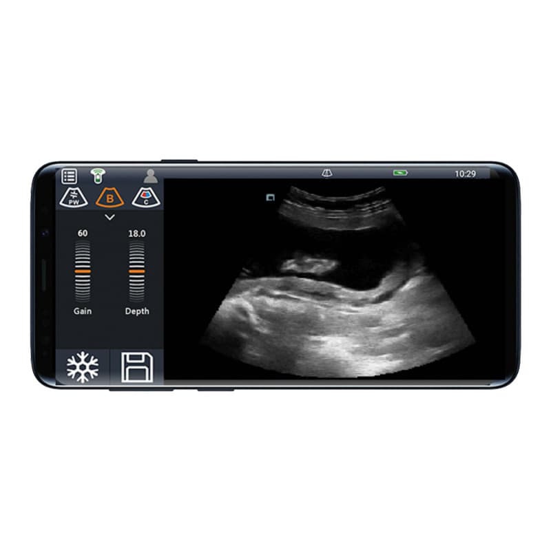 Youkey D8 Mobile Ultrasound Machine color | with convex transducer (C5-2Ks)