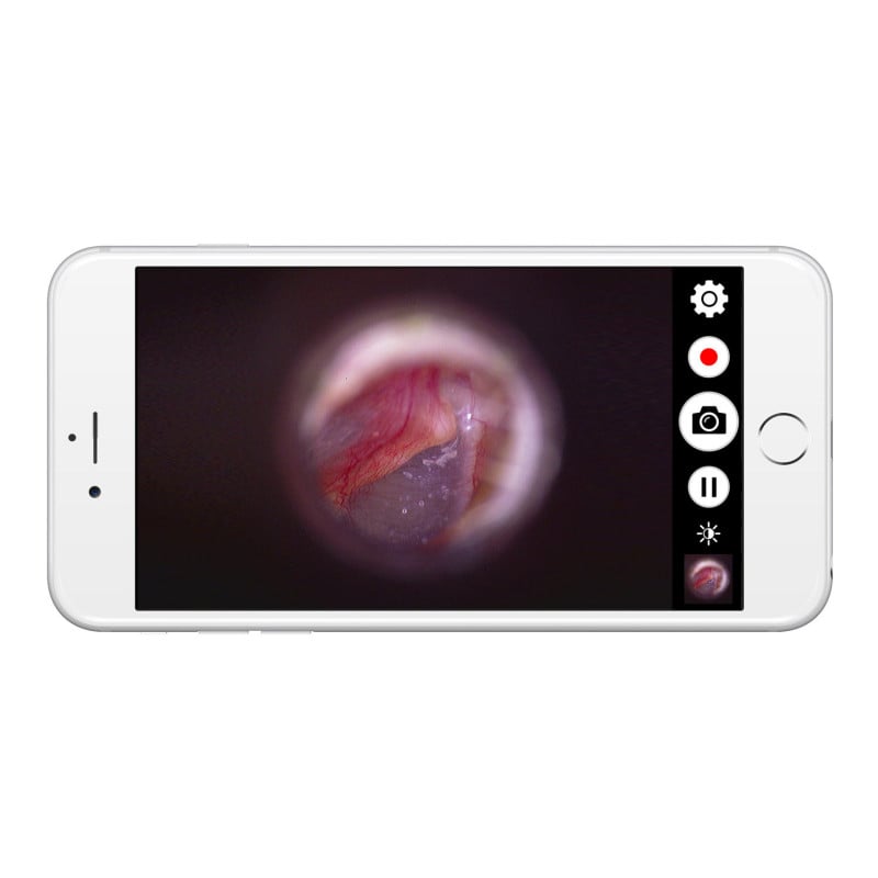 Firefly DE570 W-LAN HD Digital Otoscope