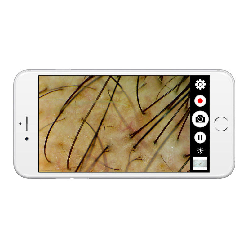 Firefly DE370 HD Mobile Wireless Polarizing Dermatoscope