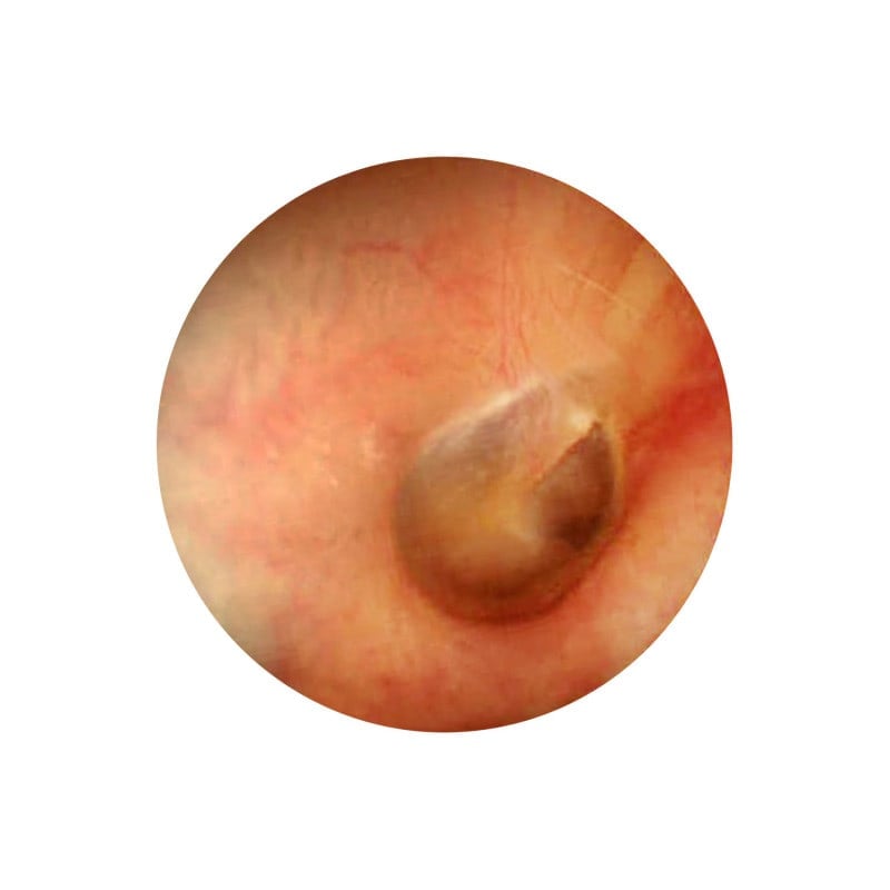 LuxaScope Auris CCT grey