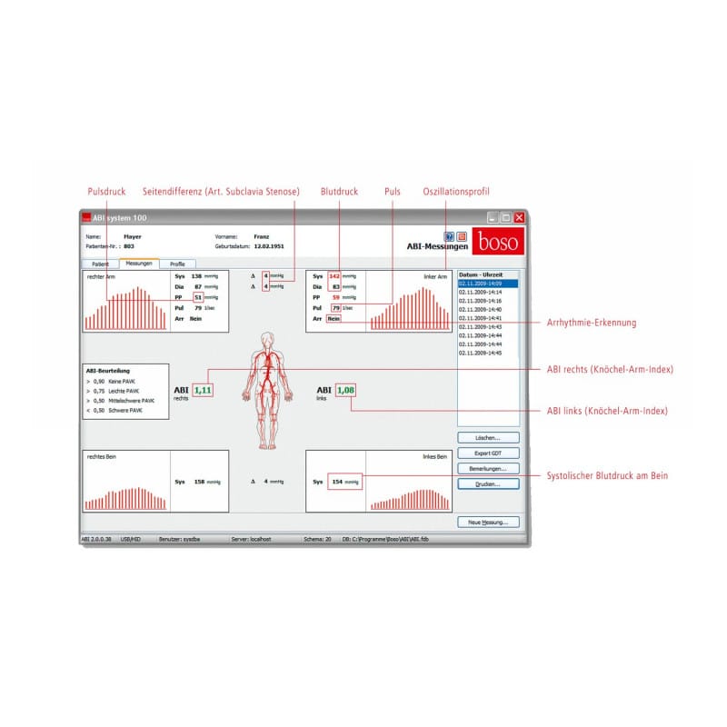 boso ABI System 100 with Pulse Wave Velocity Measurement Function | silver
