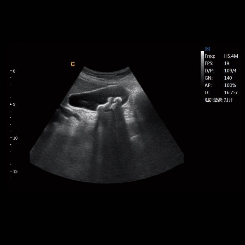 CHISON EBit 30 incl. Ultrasound Trolley with battery | without height adjustment