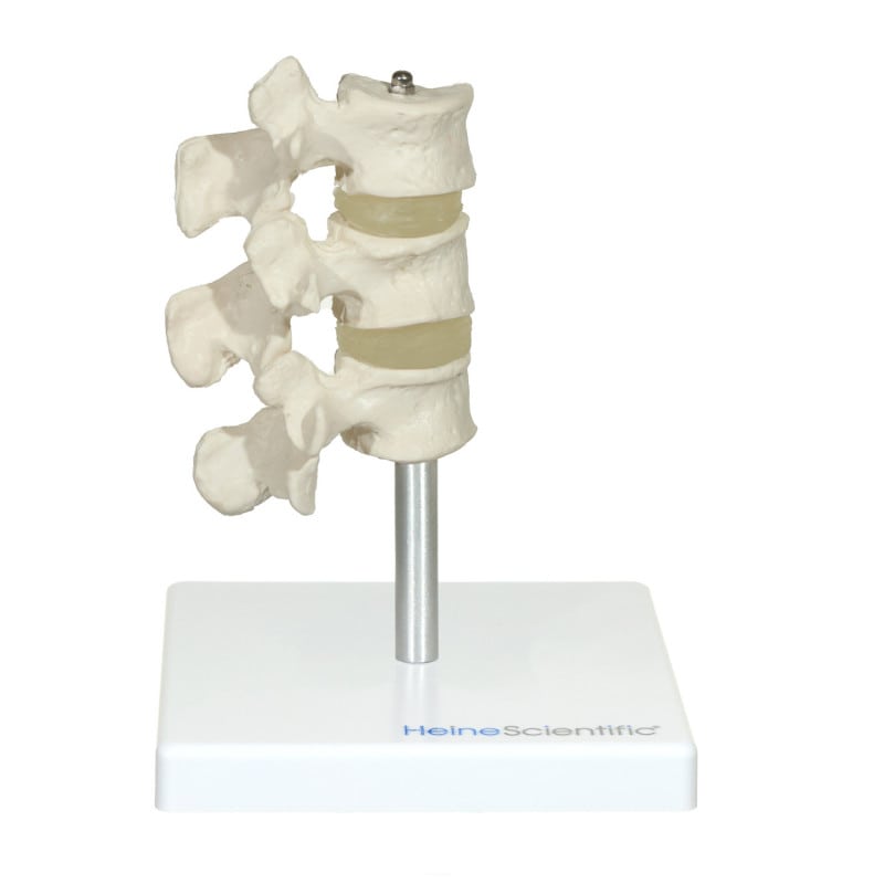 Osteoporosis Model