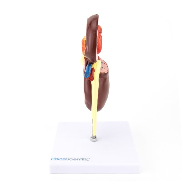 Kidney Model with Diseases