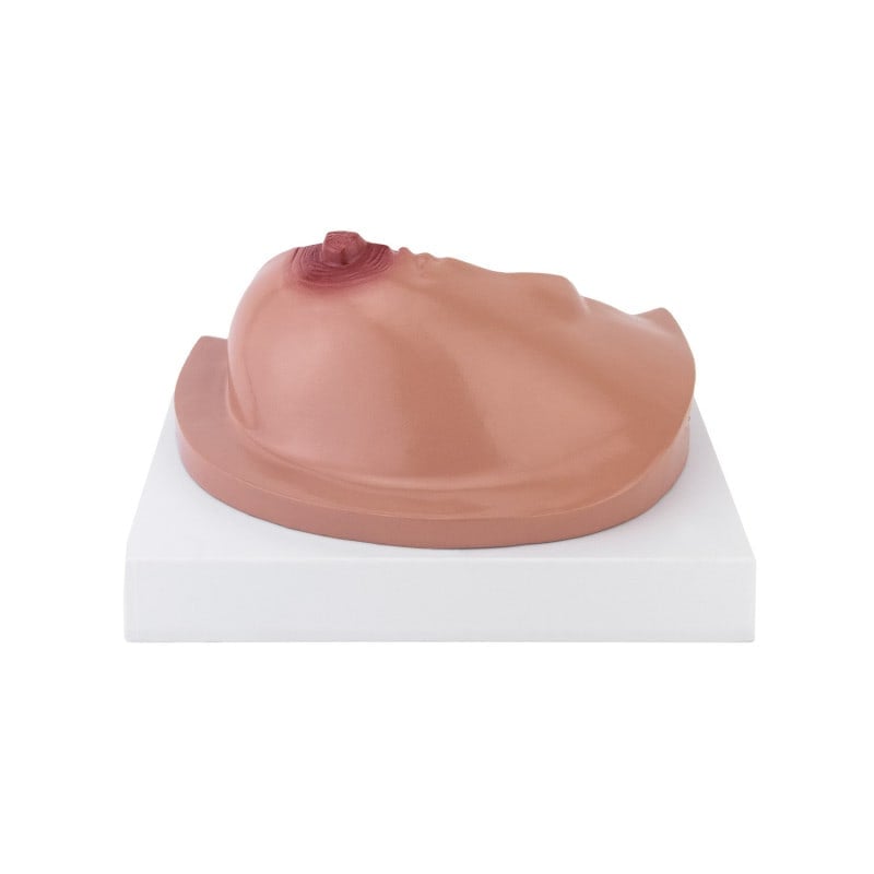 Female Breast Model with Diseases