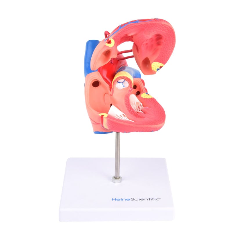 Heart Model with Bypass