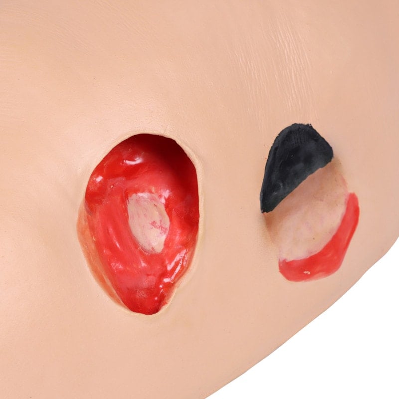 DECUBITUS DAN Treatment Simulator