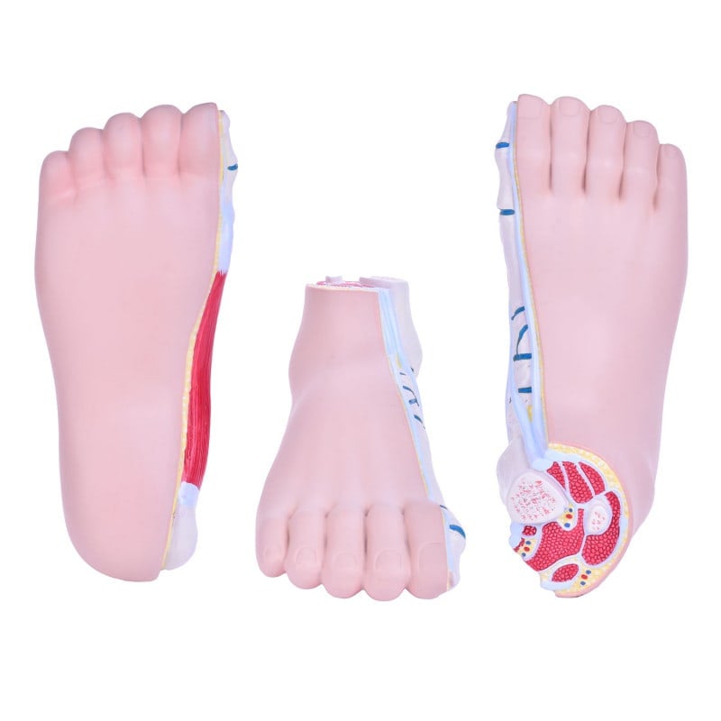 Model of Foot Malpositions