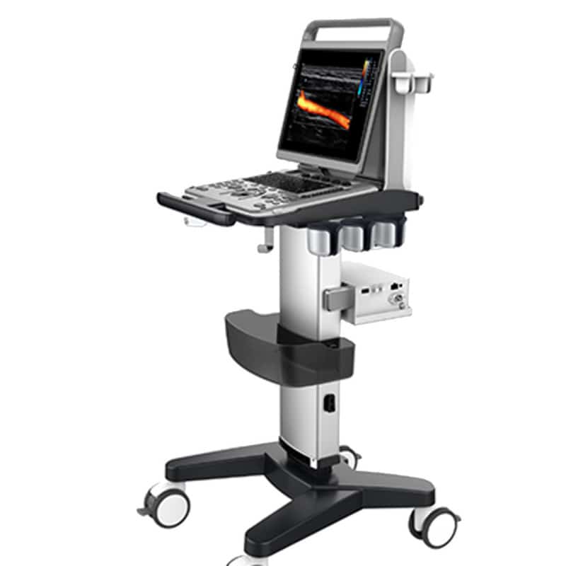CHISON EBit 30 incl. Ultrasound Trolley with battery | without height adjustment