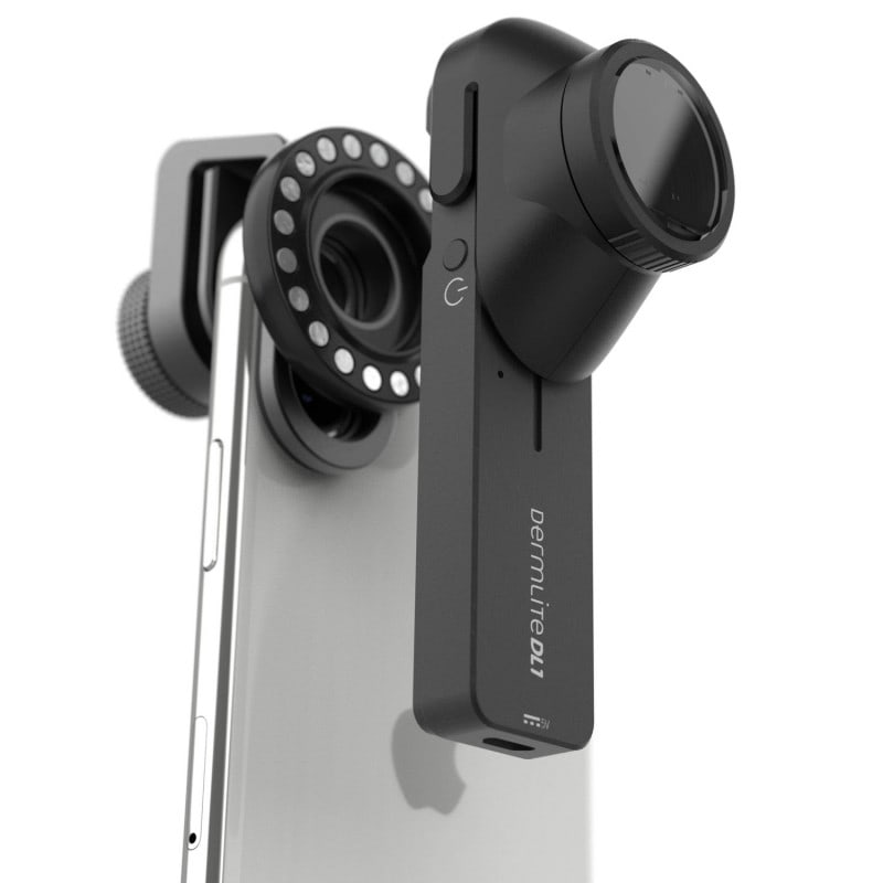 DermLite DL1