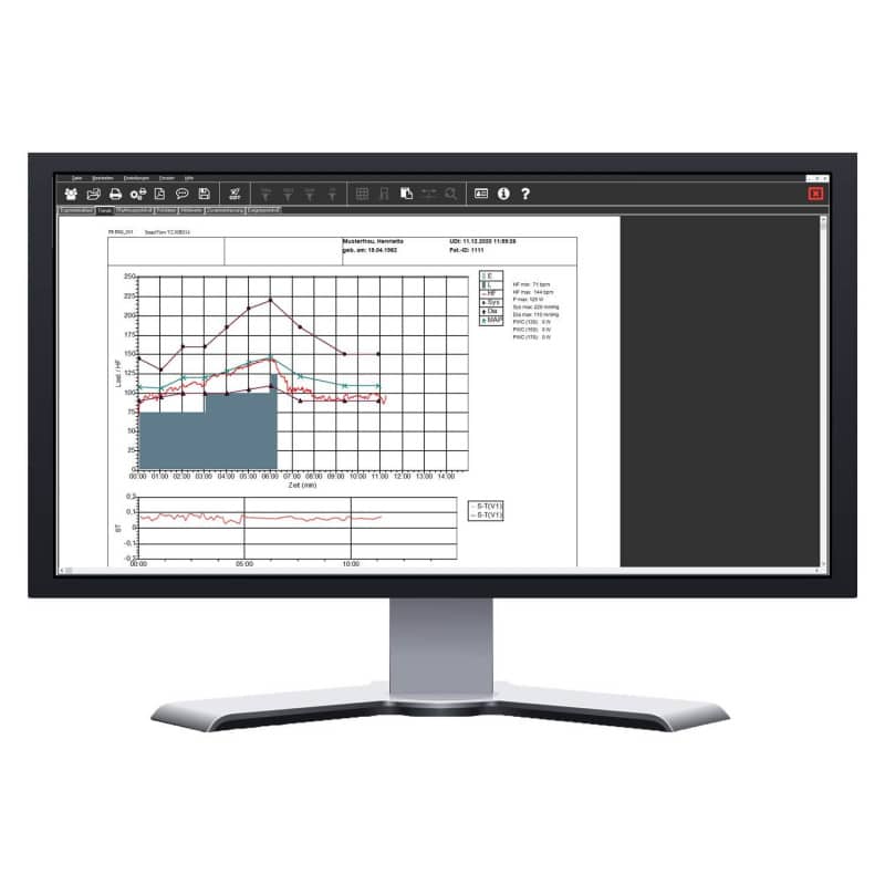 SmartScript Ergometry Basis Package Plus