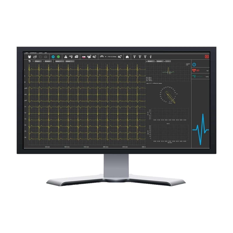 SmartScript PC-ECG System USB | Basic