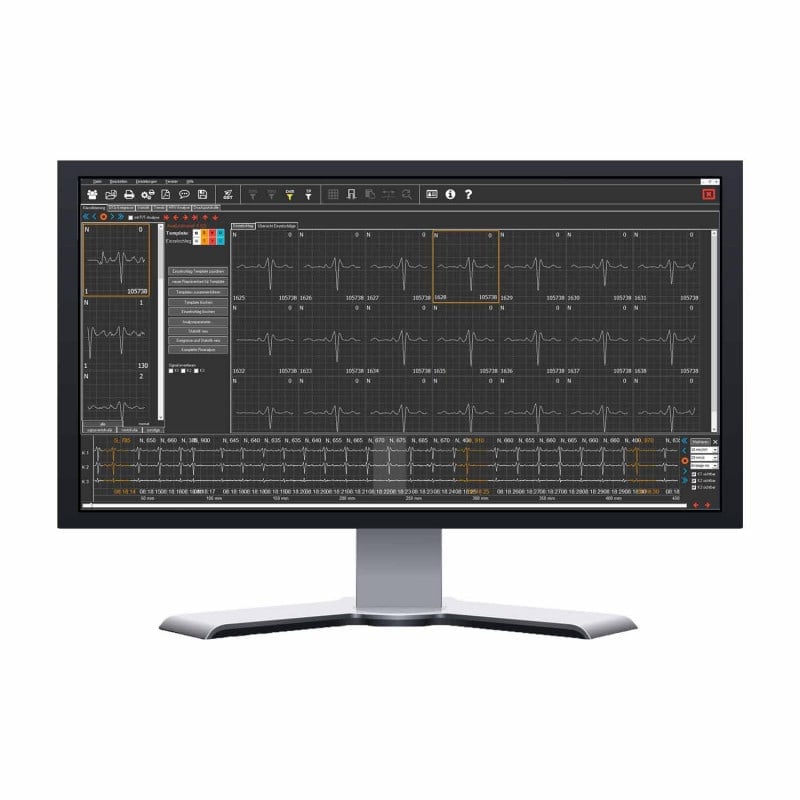 Kobold II Long-Term ECG Evaluation Package