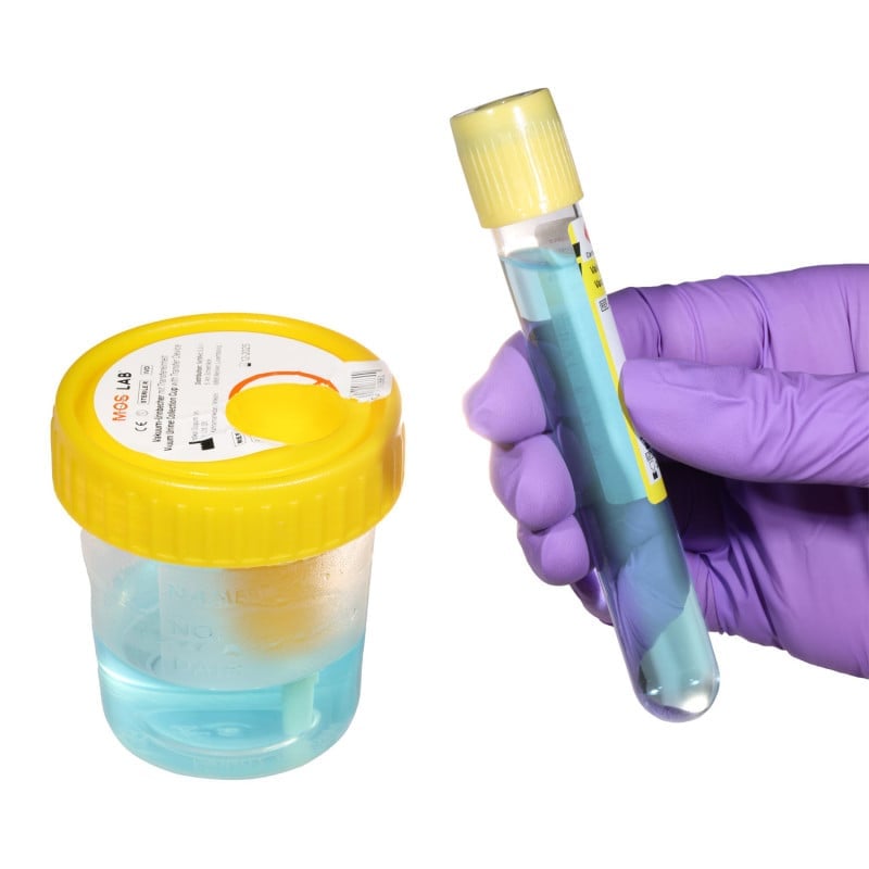 Vacuum Urine Tube