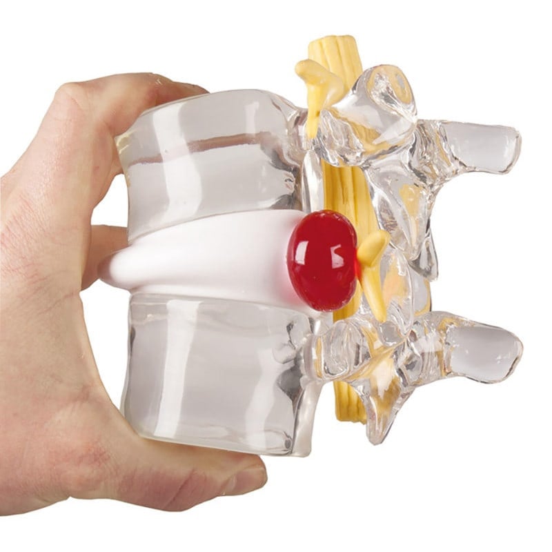 Herniated Disc Simulator