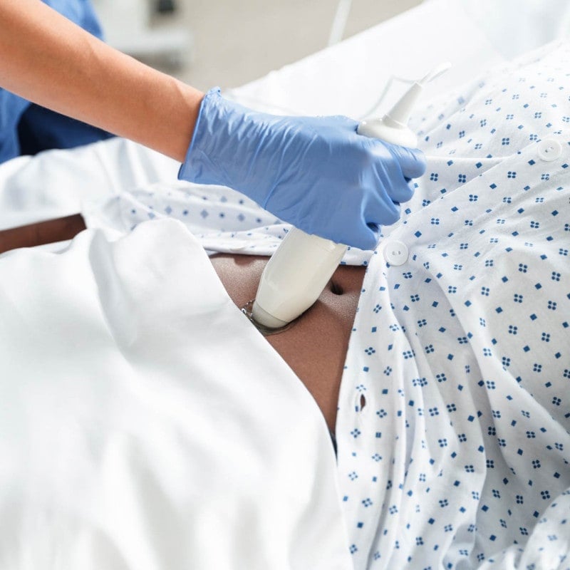 Vitascan LT Bladder Scanner with Microsoft Surface Tablet