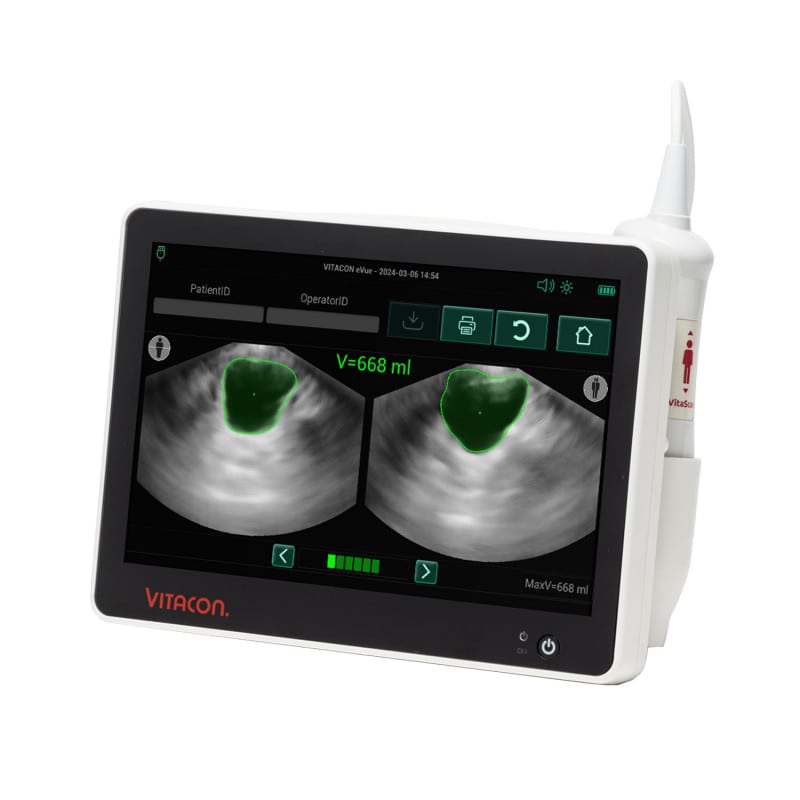 Vitascan eVue Bladder Scanner