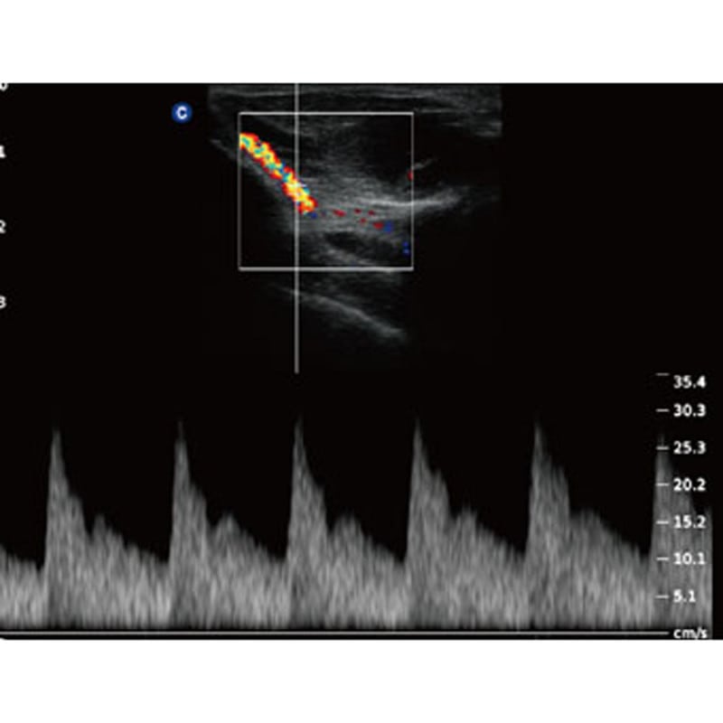 QBit 5 Ultrasound Machine without battery