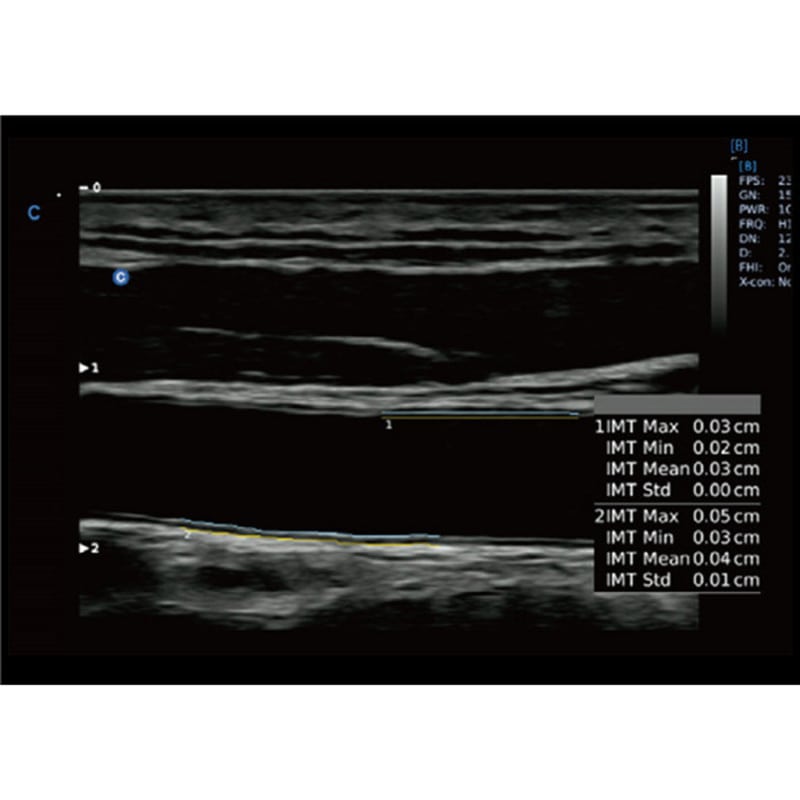 CBit6 Ultrasound Machine with battery