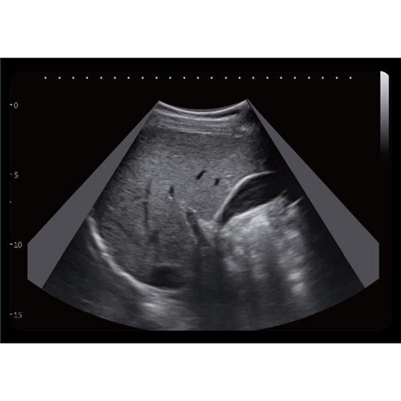 CBit6 Ultrasound Machine with battery