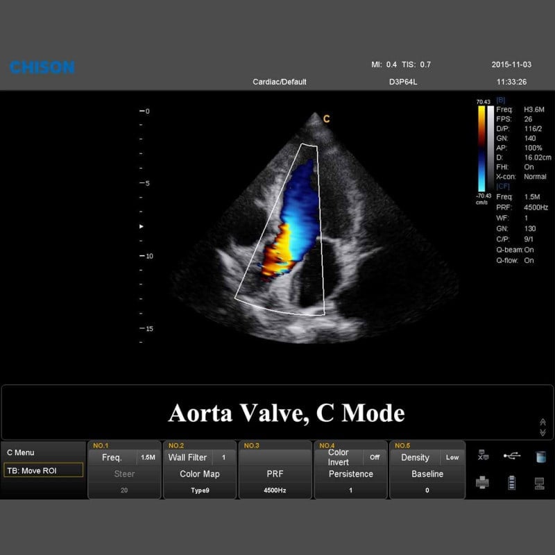 QBit 7 Ultrasound System