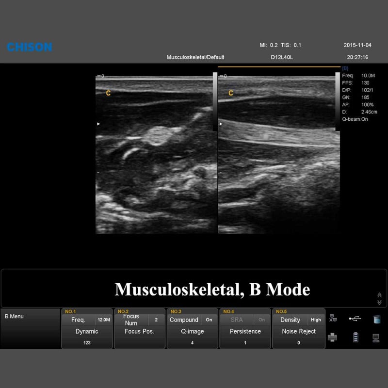 QBit 7 Ultrasound System