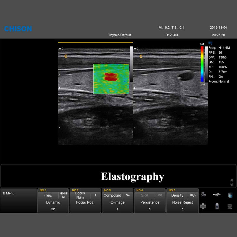 QBit 9 Ultrasound System