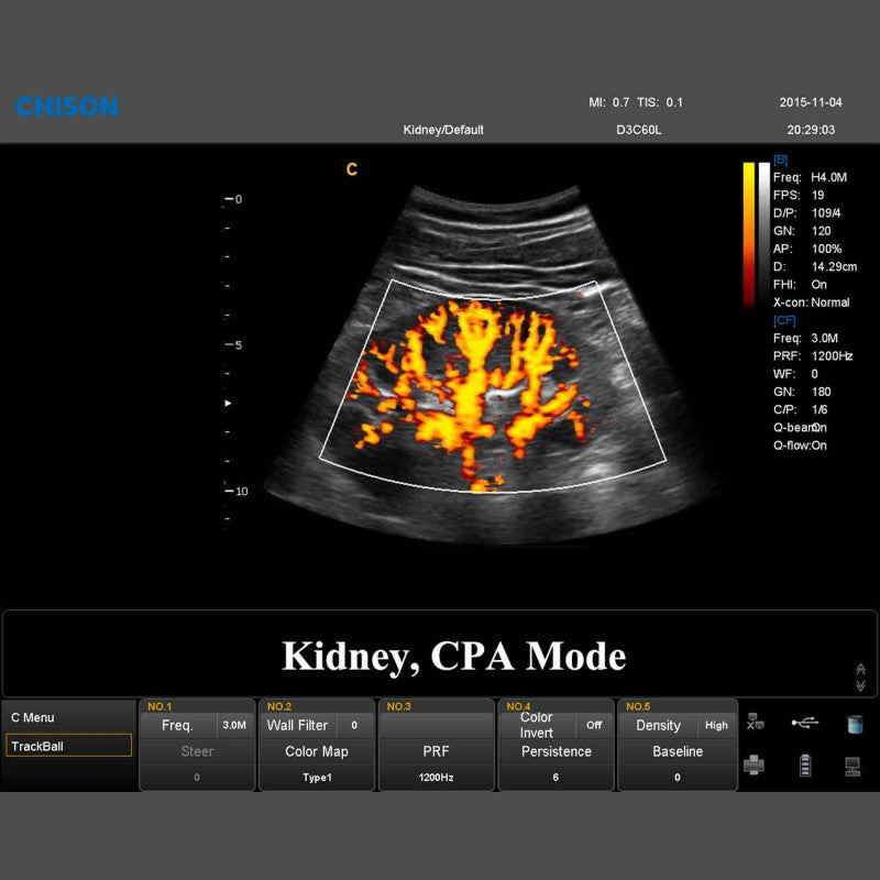 QBit 9 Ultrasound System