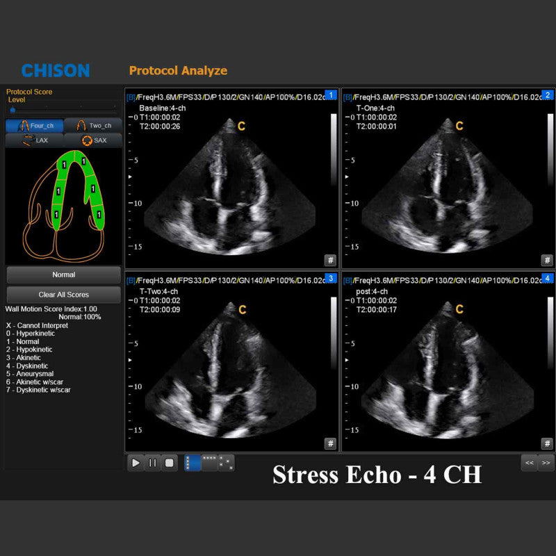 QBit 9 Ultrasound System