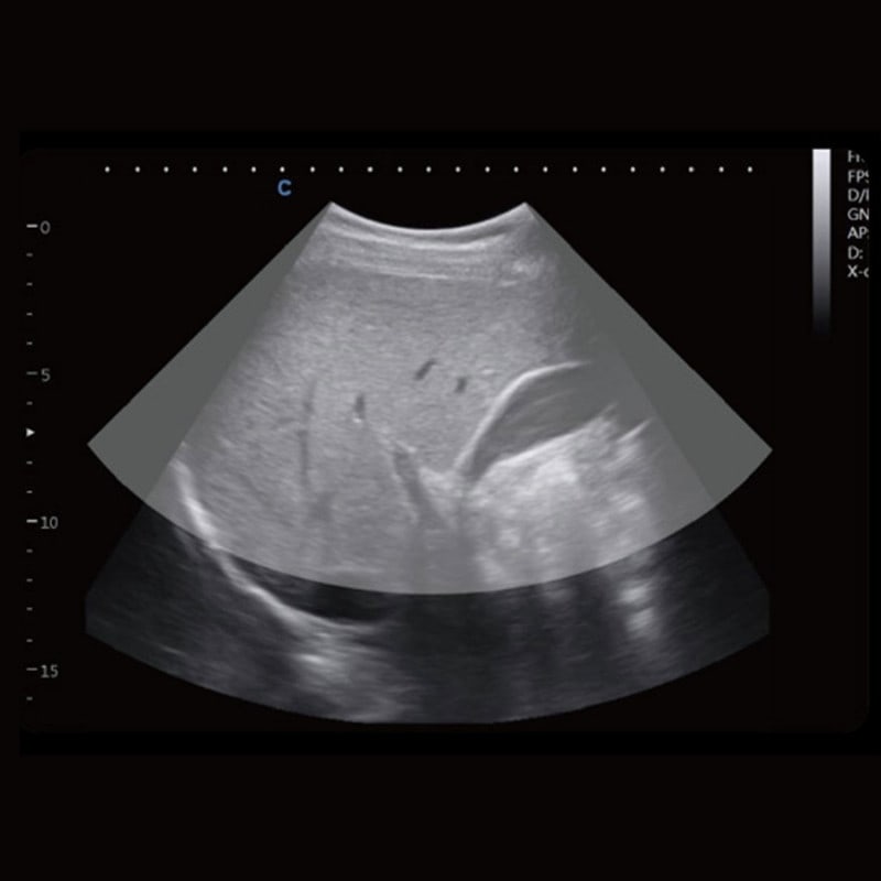 CBit 4 Ultrasound System