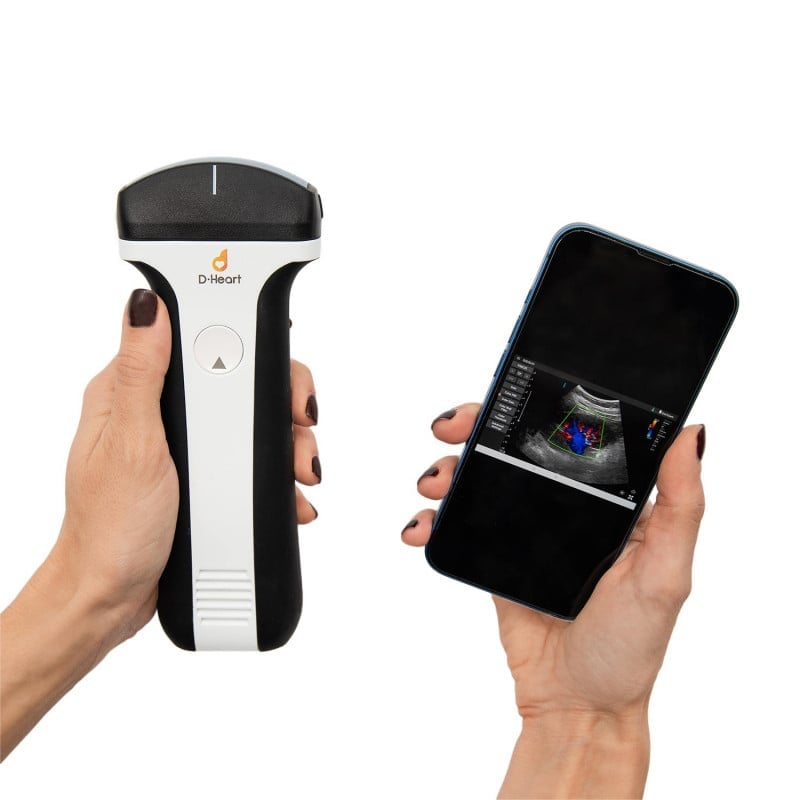 D-Heart Handheld Ultrasound Scanner convex | with tablet