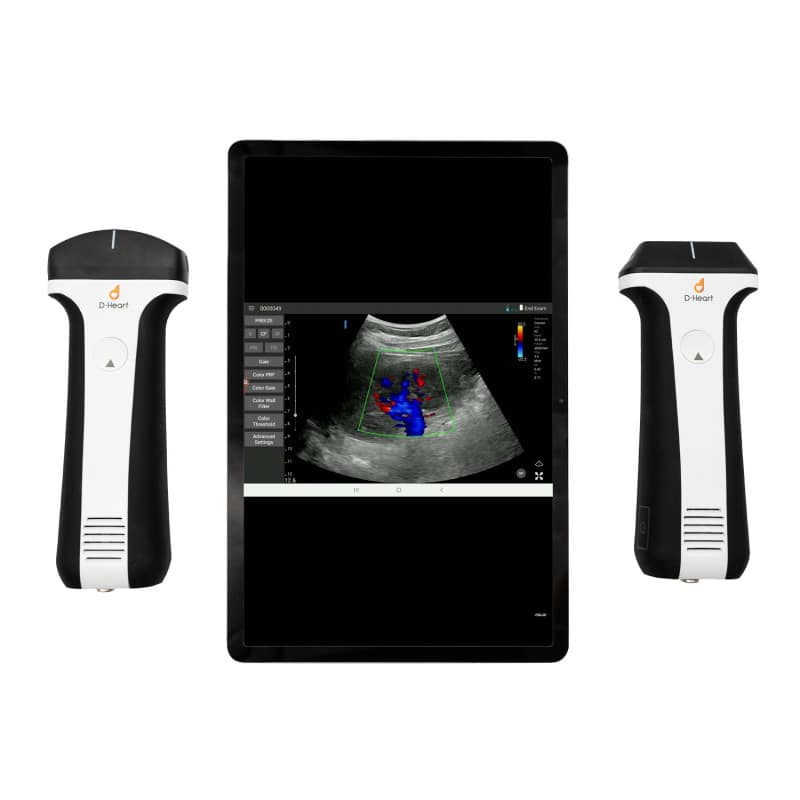 D-Heart Linear + Convex Scanner