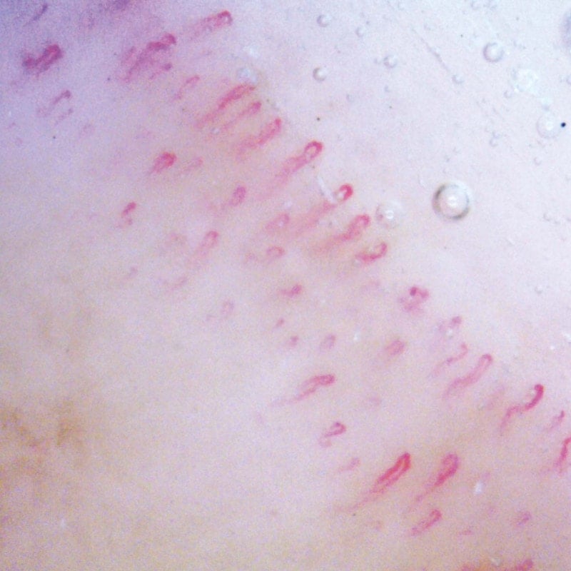 Dino-Lite CapillaryScope 500