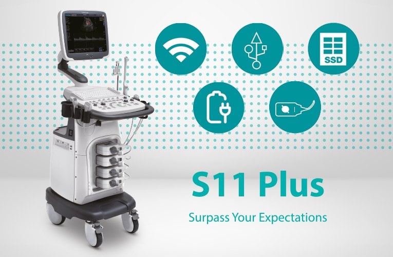 SonoScape S11 Plus ultrasound system battery included