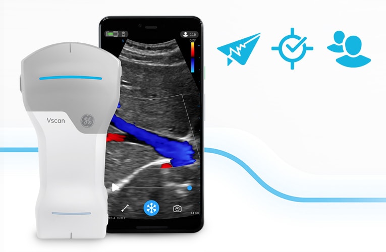 Vscan Air™ CL Ultrasound System