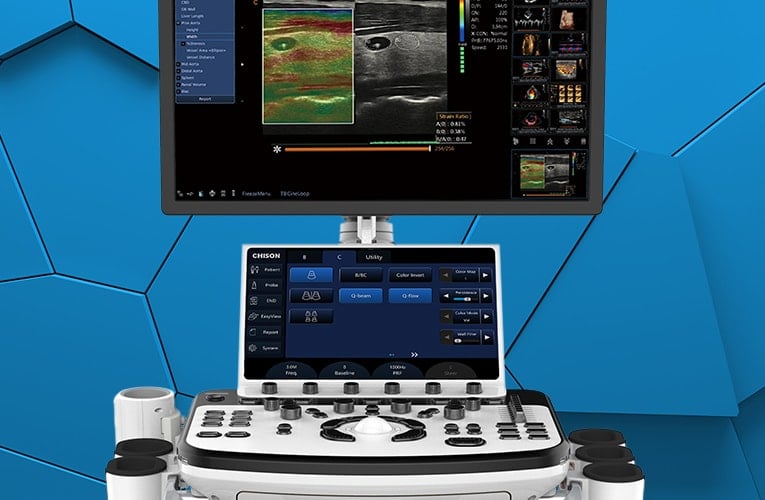 XBit 80 Color Doppler Ultrasound System without battery