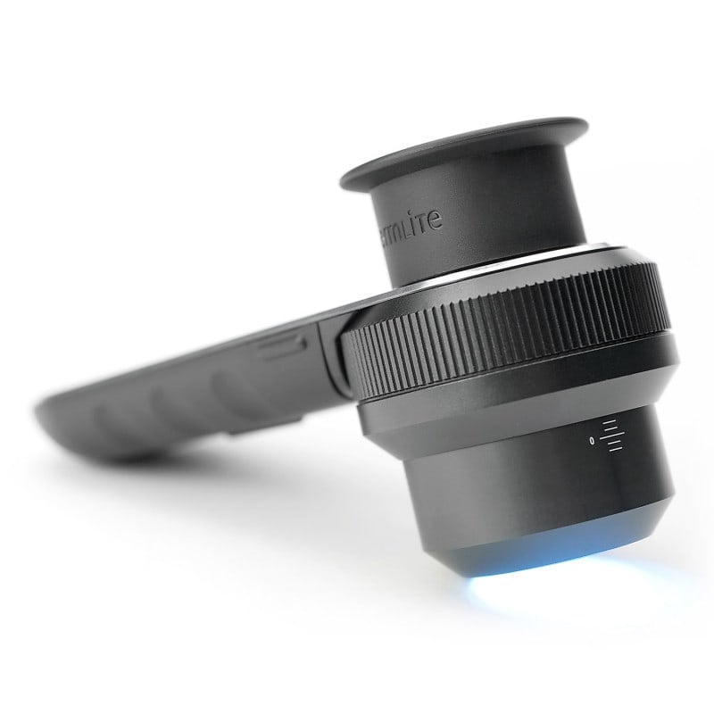 DermLite DL3N Dermatoscope