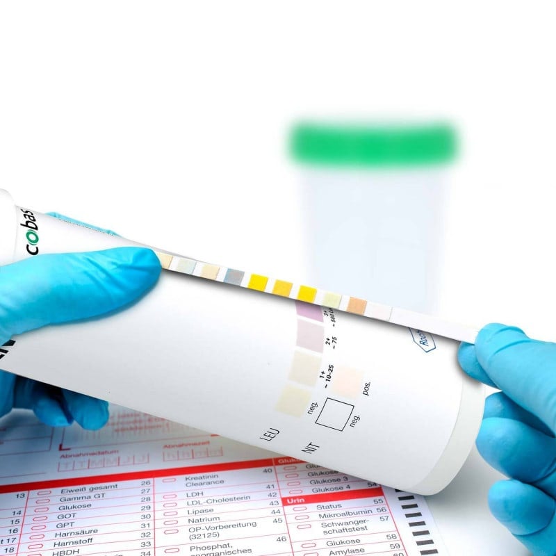 Combur 2 Test LN, 50 pcs.