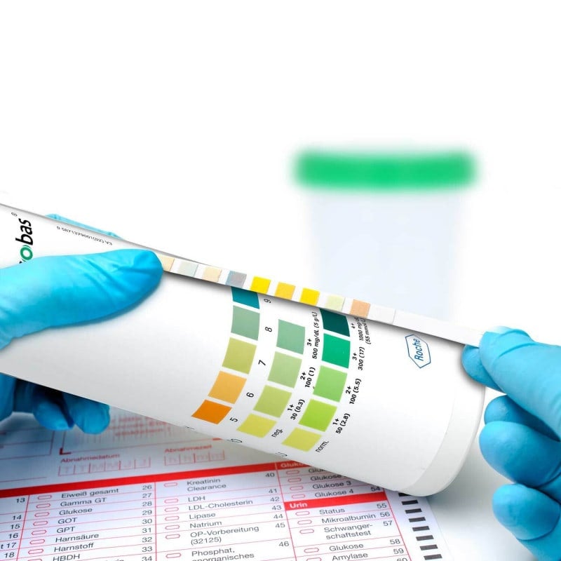 Combur 3 Test, 50 pcs.